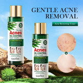 سفارش تونر صورت ضد جوش و آکنه تی تری سادور tea tree