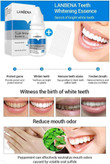 خرید اینترنتی بهترین محلول سفید و درخشان کننده دندان لانبنا