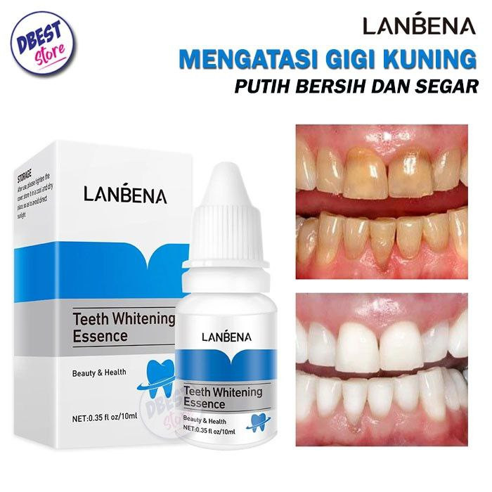 سفارش محلول سفید و درخشان کننده دندان لانبنا اصل