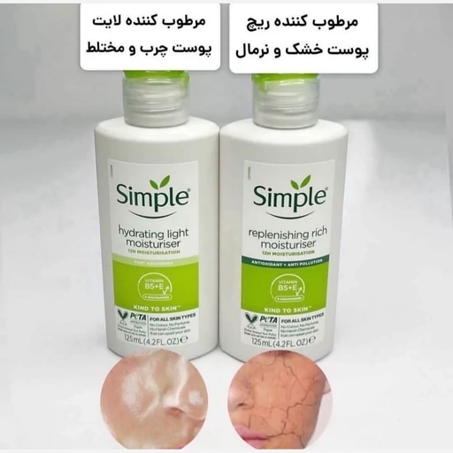 خرید اینترنتی کرم آبرسان و مرطوب کننده ریچ و لایت سیمپل برای پوست صورت