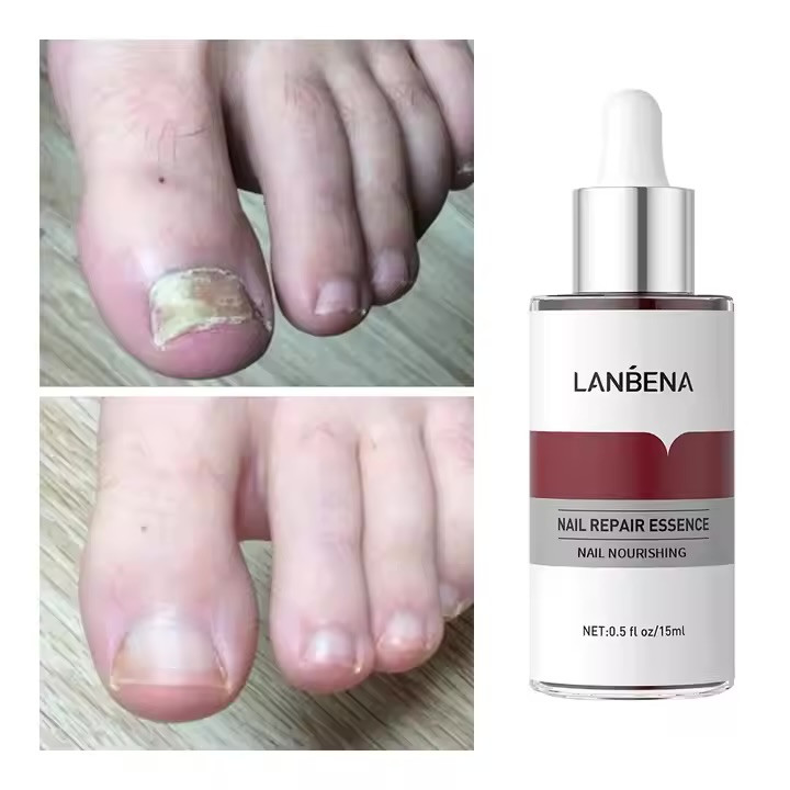 قیمت سرم ترمیم و تقویت کننده ناخن لانبنا Lanbena